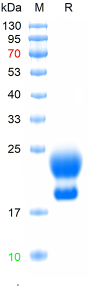 Recombinant  human WAP four-disulfide core domain protein 2, His (HEK293)