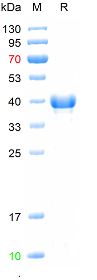 Recombinant  EV71 VP1 protein, N-His