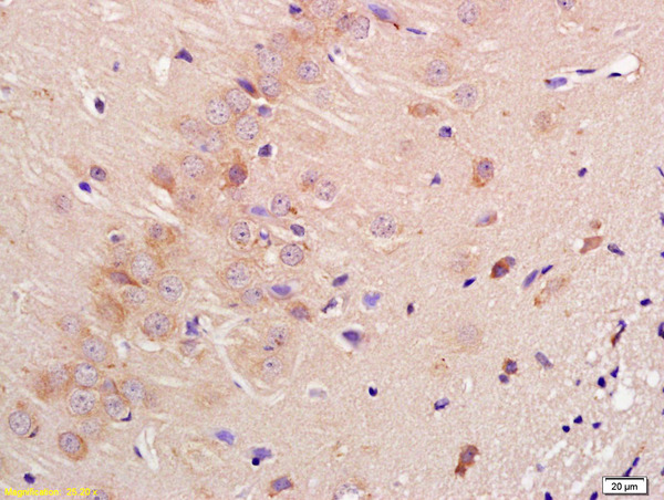 Formalin-fixed and paraffin embedded rat brain labeled with Anti-Contactin 3 Polyclonal Antibody, Unconjugated (bs-6033R) at 1:200 followed by conjugation to the secondary antibody and DAB staining