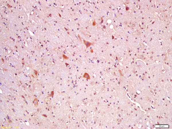 Formalin-fixed and paraffin embedded rat brain labeled with Anti-Wnt8A Polyclonal Antibody, Unconjugated (bs-6129R) at 1:200 followed by conjugation to the secondary antibody and DAB staining Formalin-fixed and paraffin embedded rat brain labeled with Anti-Wnt8A Polyclonal Antibody, Unconjugated (bs-6129R) at 1:200 followed by conjugation to the secondary antibody and DAB staining