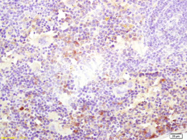 Formalin-fixed and paraffin embedded mouse spleen labeled with Rabbit Anti Kinesin Polyclonal Antibody, Unconjugated (bs-11026R) at 1:200 followed by conjugation to the secondary antibody and DAB staining