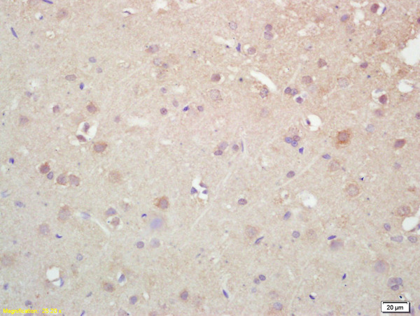 Formalin-fixed and paraffin embedded rat brain labeled with Rabbit Anti KIF5A/NKHC1 Polyclonal Antibody, Unconjugated (bs-11027R) at 1:200 followed by conjugation to the secondary antibody and DAB staining