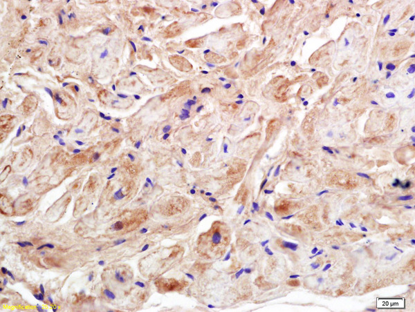 Formalin-fixed and paraffin embedded rat heart labeled with Anti-Ryanodine Receptor  Polyclonal Antibody, Unconjugated (bs-6305R) at 1:200 followed by conjugation to the secondary antibody and DAB staining