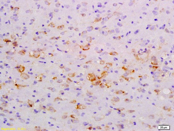 Formalin-fixed and paraffin embedded rat brain labeled with Anti-NFkB Inducing Kinase NIK Polyclonal Antibody, Unconjugated (bs-0074R) at 1:200 followed by conjugation to the secondary antibody and DAB staining\\n