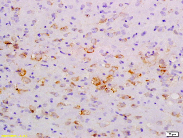 Formalin-fixed and paraffin embedded rat brain labeled with Anti-NFkB Inducing Kinase NIK Polyclonal Antibody, Unconjugated (bs-0074R) at 1:200 followed by conjugation to the secondary antibody and DAB staining\n