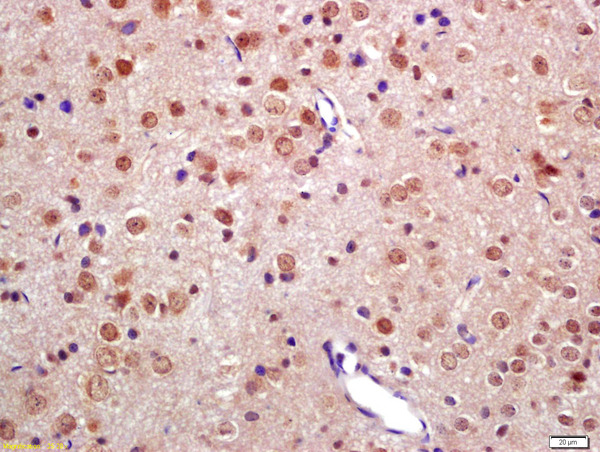 Formalin-fixed and paraffin embedded rat brain labeled with Anti-TNIP2 Polyclonal Antibody, Unconjugated (bs-7563R) at 1:200 followed by conjugation to the secondary antibody and DAB staining