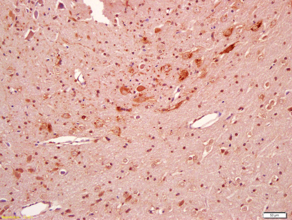 Formalin-fixed and paraffin embedded rat brain labeled with Anti-BBS5 Polyclonal Antibody, Unconjugated (bs-9438R) at 1:200 followed by conjugation to the secondary antibody and DAB staining