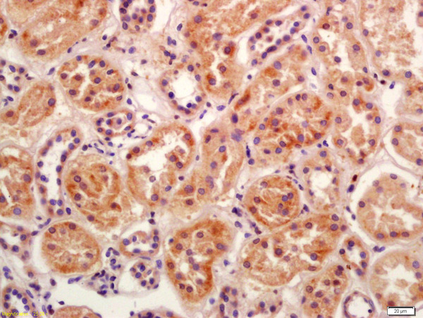 Formalin-fixed and paraffin embedded human kidney labeled with Anti-BBS5 Polyclonal Antibody, Unconjugated (bs-9438R) at 1:200 followed by conjugation to the secondary antibody and DAB staining