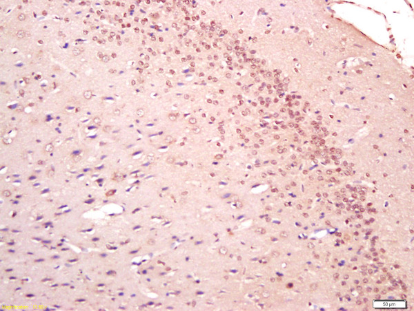 Formalin-fixed and paraffin embedded rat brain labeled with DLG1+3 Polyclonal Antibody, Unconjugated (bs-11315R) at 1:200 followed by conjugation to the secondary antibody and DAB staining Formalin-fixed and paraffin embedded rat brain labeled with DLG1+3 Polyclonal Antibody, Unconjugated (bs-11315R) at 1:200 followed by conjugation to the secondary antibody and DAB staining
