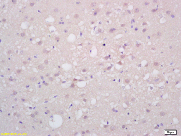 Formalin-fixed and paraffin embedded rat brain labeled with  Rabbit Anti PAX6 Polyclonal Antibody, Unconjugated (bs-11204R) at 1:200 followed by conjugation to the secondary antibody and DAB staining