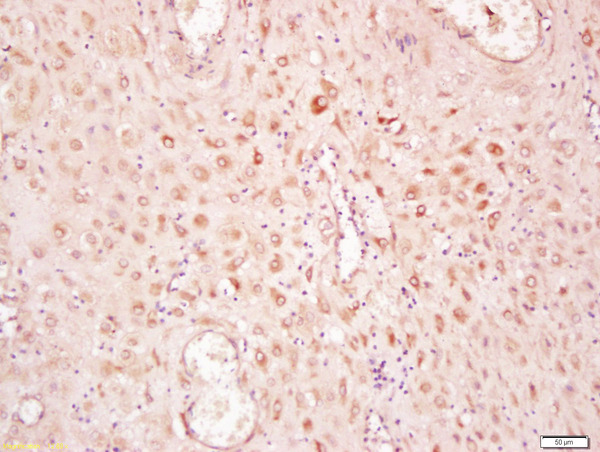 Formalin-fixed and paraffin embedded human placenta labeled with Anti-phospho-SMAD2(Ser425) Polyclonal Antibody, Unconjugated (bs-0457R) at 1:200 followed by conjugation to the secondary antibody and DAB staining\\n