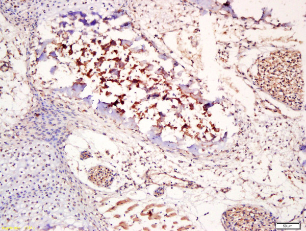 Formalin-fixed and paraffin embedded mouse embryonic bone labeled with Anti-Osteocalcin Polyclonal Antibody, Unconjugated (bs-0470R) at 1:200 followed by conjugation to the secondary antibody and DAB staining\n