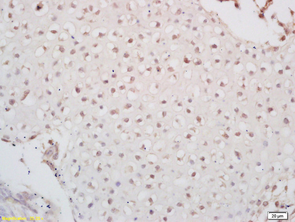 Formalin-fixed and paraffin embedded mouse embryo labeled with  Rabbit Anti Pax6 Polyclonal Antibody, Unconjugated (bs-11204R) at 1:200 followed by conjugation to the secondary antibody and DAB staining