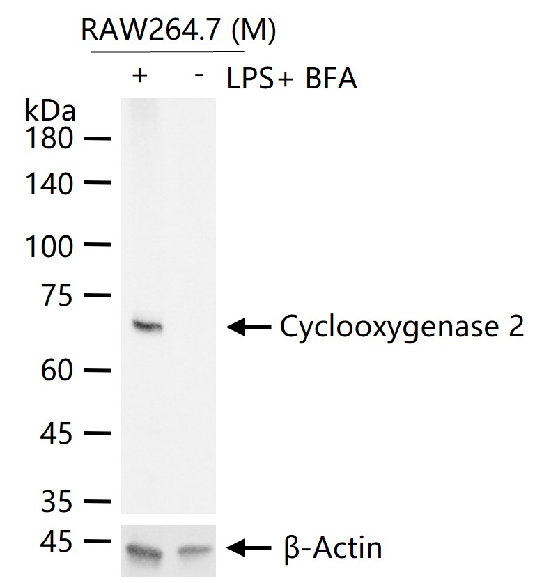 COX2/Cyclooxygenase 2 Recombinant Antibody