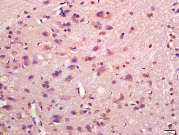 Formalin-fixed and paraffin embedded rat brain labeled with Anti-MAPKAP Kinase 2 Polyclonal Antibody, Unconjugated (bs-2908R) at 1:200 followed by conjugation to the secondary antibody and DAB staining