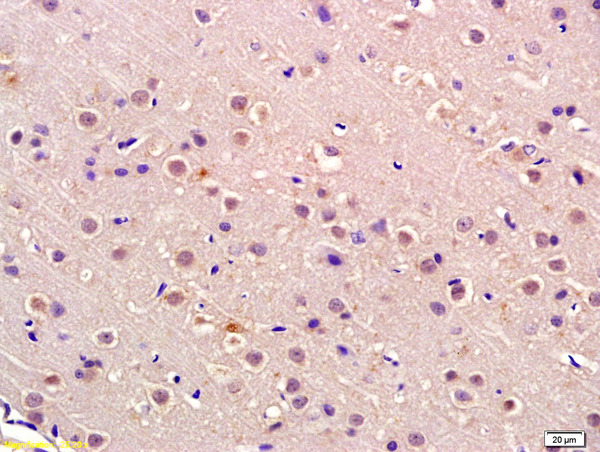 Formalin-fixed and paraffin embedded rat brain labeled with Anti-P105 RB  Polyclonal Antibody, Unconjugated (bs-2777R) at 1:200 followed by conjugation to the secondary antibody and DAB staining\\n