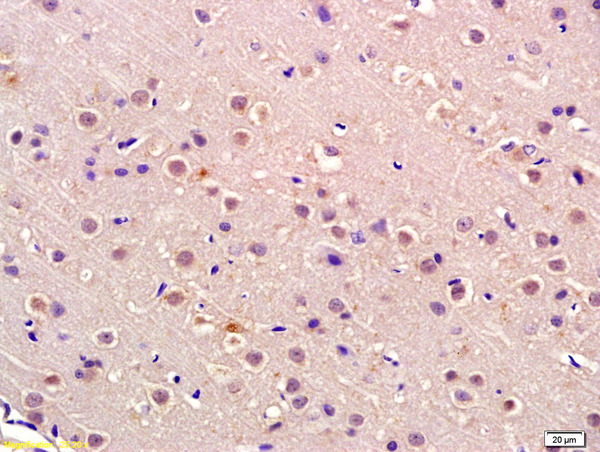 Formalin-fixed and paraffin embedded rat brain labeled with Anti-P105 RB Polyclonal Antibody, Unconjugated (bs-2777R) at 1:200 followed by conjugation to the secondary antibody and DAB staining\n