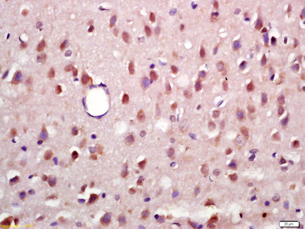 Formalin-fixed and paraffin embedded rat brain labeled with Anti-Phospho-RSK2 (Ser227) Polyclonal Antibody, Unconjugated (bs-3367R) at 1:200 followed by conjugation to the secondary antibody and DAB staining