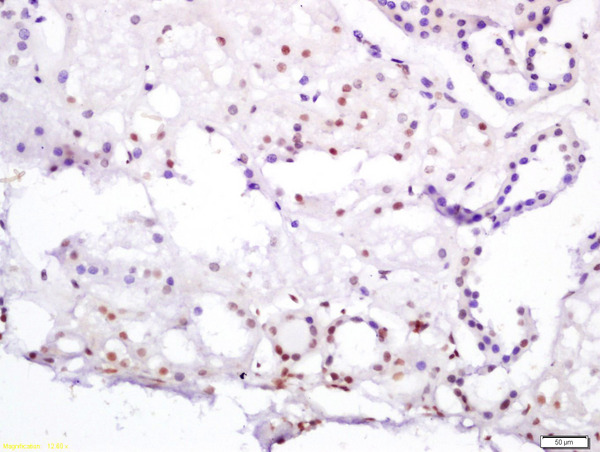 Formalin-fixed and paraffin embedded human kidney labeled with Anti-HNF4/TCF4/HNF4A Polyclonal Antibody, Unconjugated (bs-3828R) at 1:200 followed by conjugation to the secondary antibody and DAB staining
