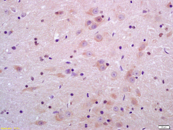 Formalin-fixed and paraffin embedded rat brain labeled with Anti-Sulfatase 2 Polyclonal Antibody, Unconjugated (bs-3894R) at 1:200 followed by conjugation to the secondary antibody and DAB staining