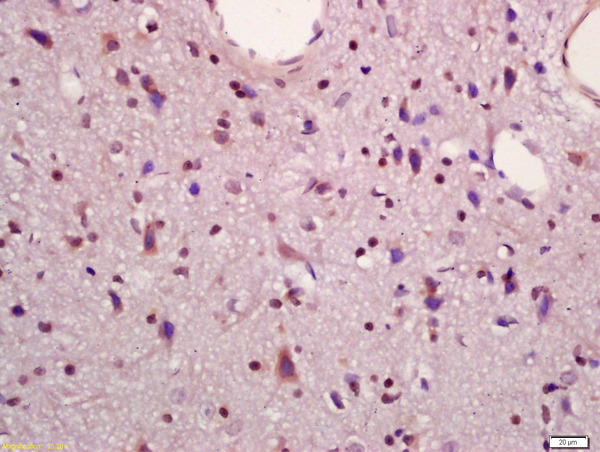 Formalin-fixed and paraffin embedded rat brain labeled with Anti-MAPKAPK5 Polyclonal Antibody, Unconjugated (bs-4137R) at 1:200 followed by conjugation to the secondary antibody and DAB staining