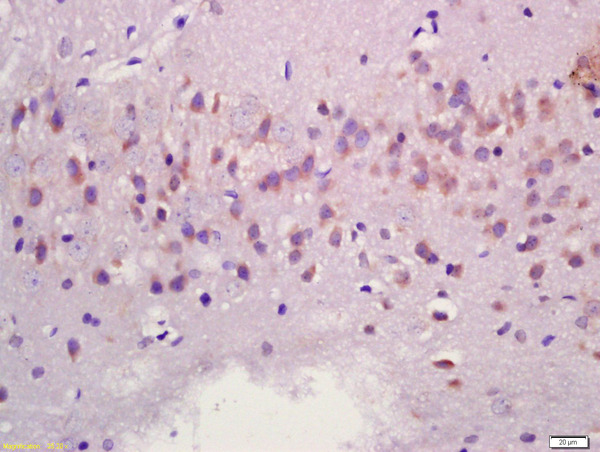 Formalin-fixed and paraffin embedded rat brain labeled with Anti-MAPK11 Polyclonal Antibody, Unconjugated (bs-4138R) at 1:200 followed by conjugation to the secondary antibody and DAB staining\n