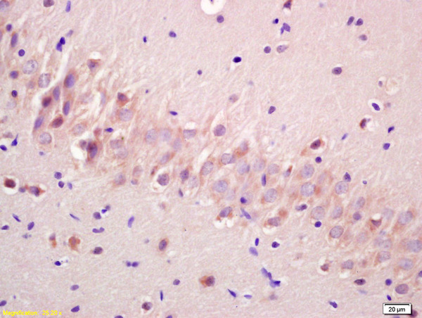 Formalin-fixed and paraffin embedded rat brain labeled with Anti-phospho-GSK3 Alpha(Ser21) Polyclonal Antibody, Unconjugated (bs-4692R) at 1:200 followed by conjugation to the secondary antibody and DAB staining