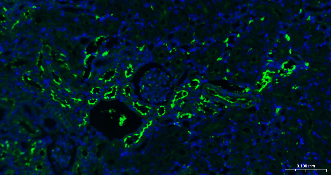 Angiotensin Converting Enzyme 2 Recombinant Antibody, AbBy Fluor-488 Conjugated
