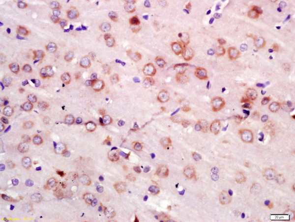 Formalin-fixed and paraffin embedded rat brain labeled with Anti-NEDD4 Polyclonal Antibody, Unconjugated (bs-7877R) at 1:200 followed by conjugation to the secondary antibody and DAB staining