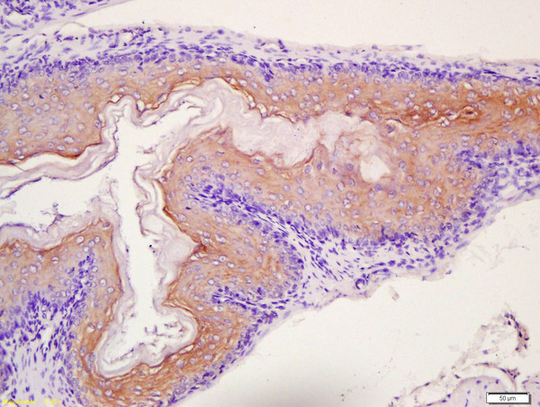 Formalin-fixed and paraffin-embedded mouse stomach labeled with TPM2 Polyclonal Antibody, Unconjugated (bs-1243R) at 1:200 followed by incubation with secondary antibody and DAB staining