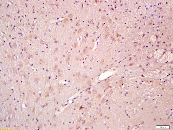 Formalin-fixed and paraffin embedded rat brain labeled with Anti-CNTF Polyclonal Antibody, Unconjugated (bs-1272R) at 1:200 followed by conjugation to the secondary antibody and DAB staining