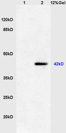 Lane 1: mouse heart lysates Lane 2: mouse S/P20 cell lysates probed with Anti phospho-ERK1(Thr202/Tyr204)+ERK2(Thr183/Tyr185) Polyclonal Antibody, Unconjugated (bs-1646R) at 1:200 in 4˚C. Followed by conjugation to secondary antibody (bs-0295G-HRP) at 1:3000 90min in 37˚C. Predicted band 42kD. Observed band size:42kD