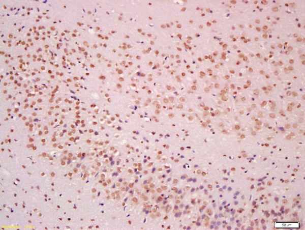 Formalin-fixed and paraffin embedded rat brain labeled with Anti-MEK3/MAP2K3 Polyclonal Antibody, Unconjugated (bs-1689R) at 1:200 followed by conjugation to the secondary antibody and DAB staining