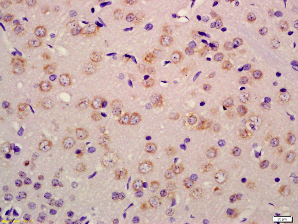Formalin-fixed and paraffin embedded rat brain labeled with Anti-RET Polyclonal Antibody, Unconjugated (bs-2793R) at 1:200 followed by conjugation to the secondary antibody and DAB staining