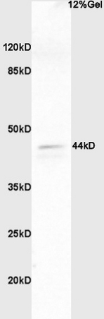 Lane 1: human colon carcinoma lysates probed with Anti phospho-ERK1/2(Thr202 + Tyr204) Polyclonal Antibody, Unconjugated (bs-3016R) at 1:200 in 4˚C. Followed by conjugation to secondary antibody (bs-0295G-HRP) at 1:3000 90min in 37˚C. Predicted band 44kD. Observed band size: 44kD