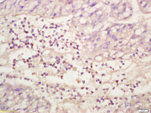 Formalin-fixed and paraffin embedded human liver labeled with Anti-phospho-ERK1\/2(Thr202 + Tyr204) Polyclonal Antibody, Unconjugated (bs-3016R) at 1:200 followed by conjugation to the secondary antibody and DAB staining