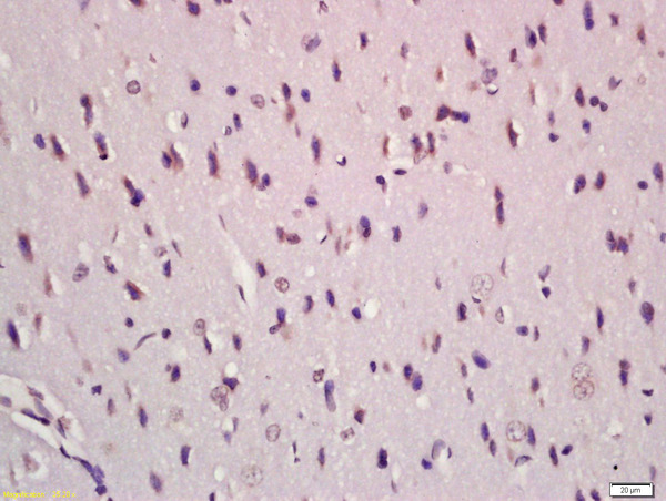 Formalin-fixed and paraffin embedded rat brain labeled with Anti-TGF Beta 1+2+3 Polyclonal Antibody, Unconjugated (bs-4538) at 1:200 followed by conjugation to the secondary antibody and DAB staining