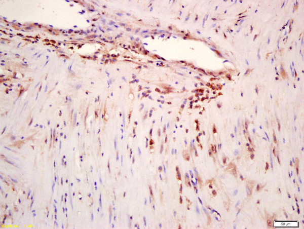 Formalin-fixed and paraffin embedded human myometrium labeled with Anti-phospho-ERK5 (Ser496) Polyclonal Antibody, Unconjugated (bs-5484R) at 1:200 followed by conjugation to the secondary antibody and DAB staining
