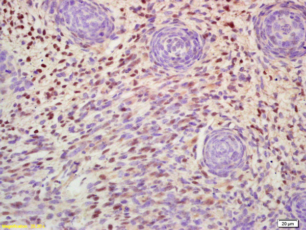 Formalin-fixed and paraffin embedded mouse embryo labeled with Anti-MSX1 Polyclonal Antibody, Unconjugated (bs-8512R) at 1:200 followed by conjugation to the secondary antibody and DAB staining\n