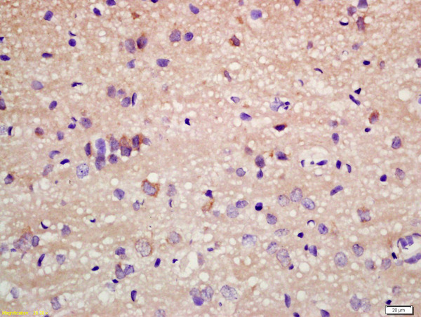 Formalin-fixed and paraffin embedded rat brain labeled with Anti-Staufen Polyclonal Antibody, Unconjugated (bs-9877R) at 1:200 followed by conjugation to the secondary antibody and DAB staining