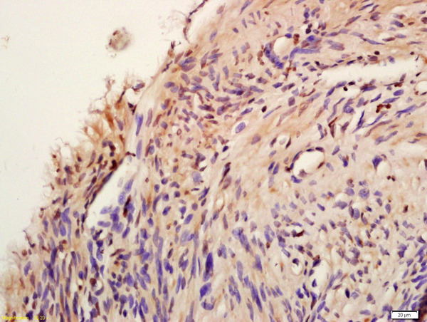 Formalin-fixed and paraffin embedded human myometrium labeled with Anti-phospho-AKT1 (Tyr474)Polyclonal Antibody, Unconjugated (bs-10133R) at 1:200 followed by conjugation to the secondary antibody and DAB staining