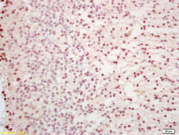 Formalin-fixed and paraffin embedded mouse embryonic brain labeled with Anti-Capicua/CIC Polyclonal Antibody, Unconjugated (bs-11721R) at 1:200 followed by conjugation to the secondary antibody and DAB staining
