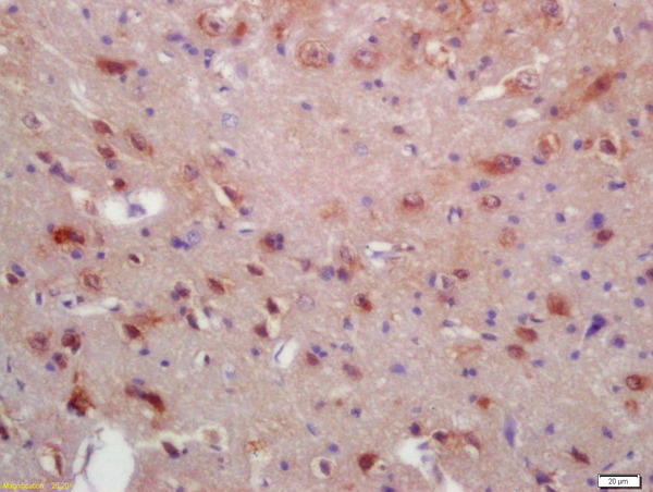 Formalin-fixed and paraffin embedded rat brain labeled with Anti-MRF\/C11orf9 Polyclonal Antibody, Unconjugated (bs-11191R) at 1:200 followed by conjugation to the secondary antibody and DAB staining