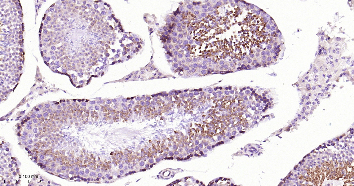 ABCE1 Recombinant Antibody