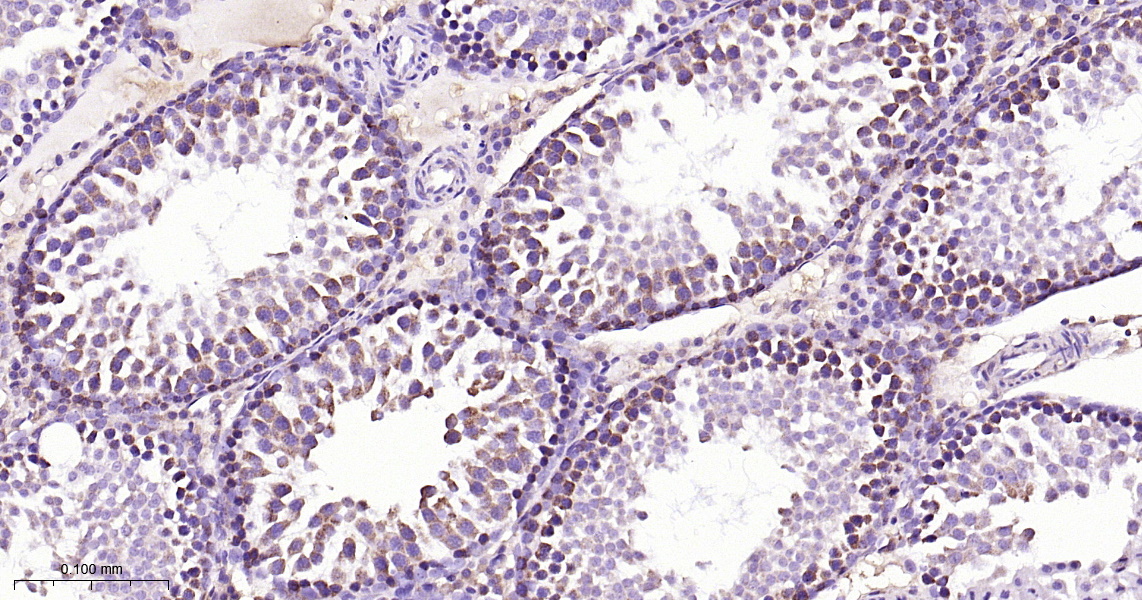 ABCE1 Recombinant Antibody