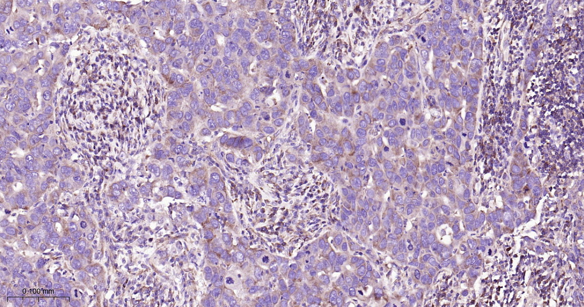 ABCE1 Recombinant Antibody