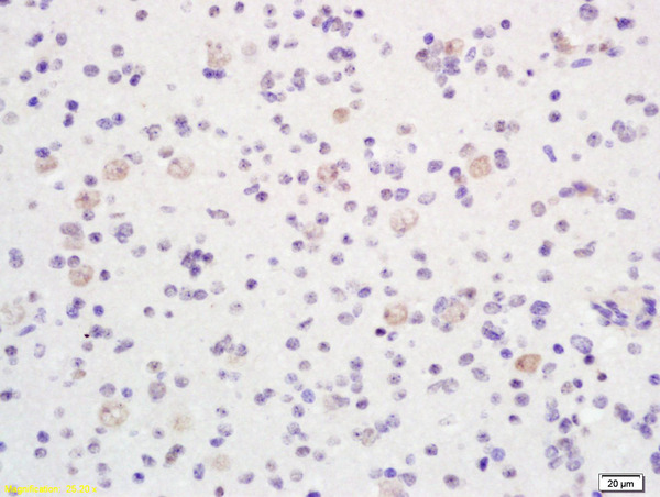 Formalin-fixed and paraffin embedded human brain labeled with Anti-phospho-LKB1 (Thr363)Polyclonal Antibody, Unconjugated (bs-1532R) at 1:200 followed by conjugation to the secondary antibody and DAB staining