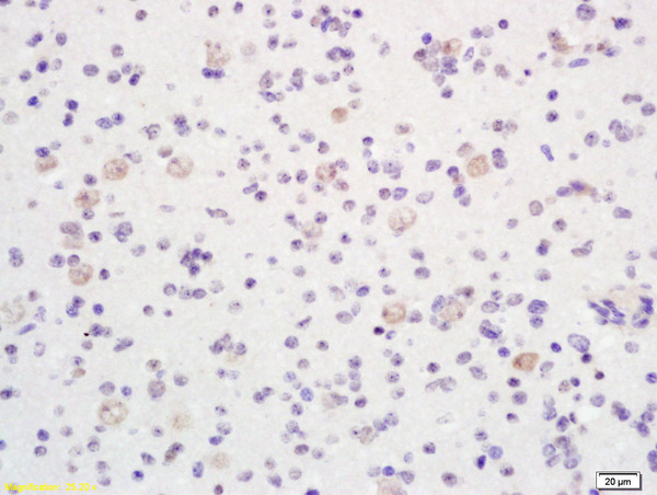 Formalin-fixed and paraffin embedded human brain labeled with Anti-phospho-LKB1 (Thr363)Polyclonal Antibody, Unconjugated (bs-1532R) at 1:200 followed by conjugation to the secondary antibody and DAB staining Formalin-fixed and paraffin embedded human brain labeled with Anti-phospho-LKB1 (Thr363)Polyclonal Antibody, Unconjugated (bs-1532R) at 1:200 followed by conjugation to the secondary antibody and DAB staining
