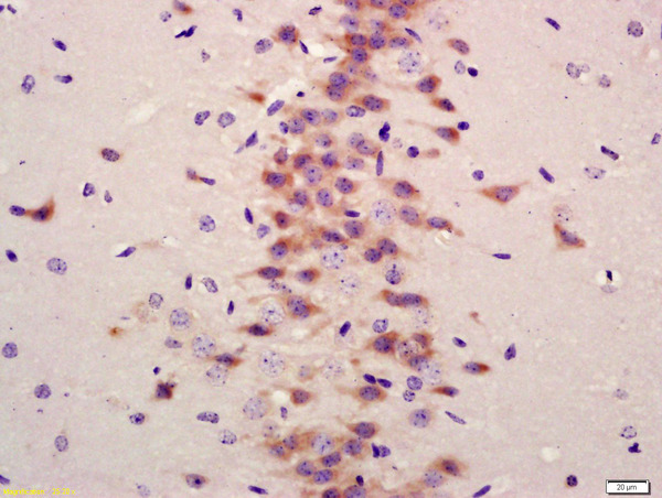 Formalin-fixed and paraffin embedded mouse brain labeled with Anti-LC3A/B Polyclonal Antibody, Unconjugated (bs-11731R) at 1:200 followed by conjugation to the secondary antibody and DAB staining