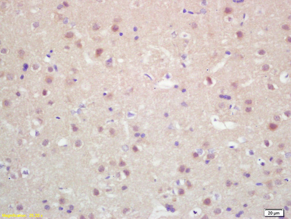 Formalin-fixed and paraffin embedded rat brain labeled with Rabbit Anti KIF20A/MKLP2 Polyclonal Antibody, Unconjugated (bs-7750R) at 1:200 followed by conjugation to the secondary antibody and DAB staining